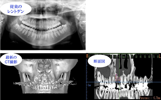 神谷町デンタルオフィスのCT検査